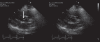 Figure 2)