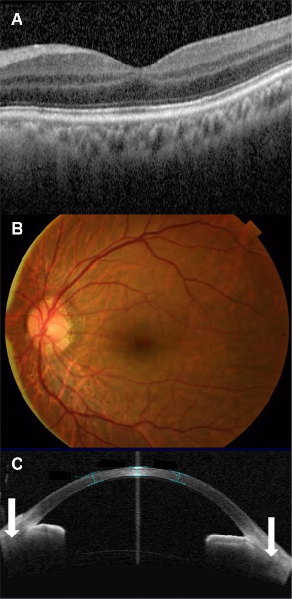 Fig. 4