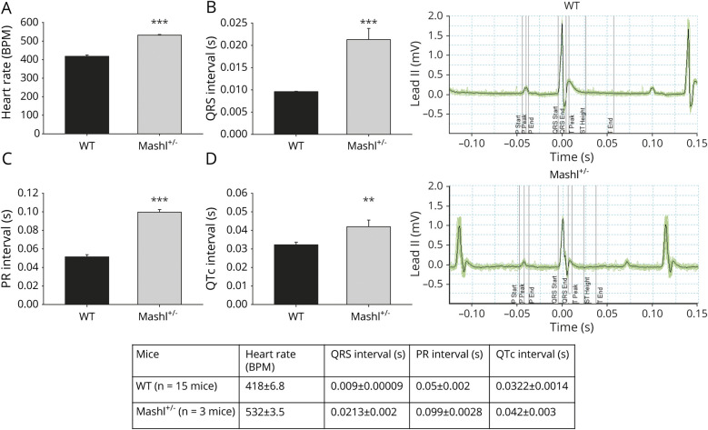 Cardiac phenotype in ATP1A3-related syndromes: A multicenter cohort ...