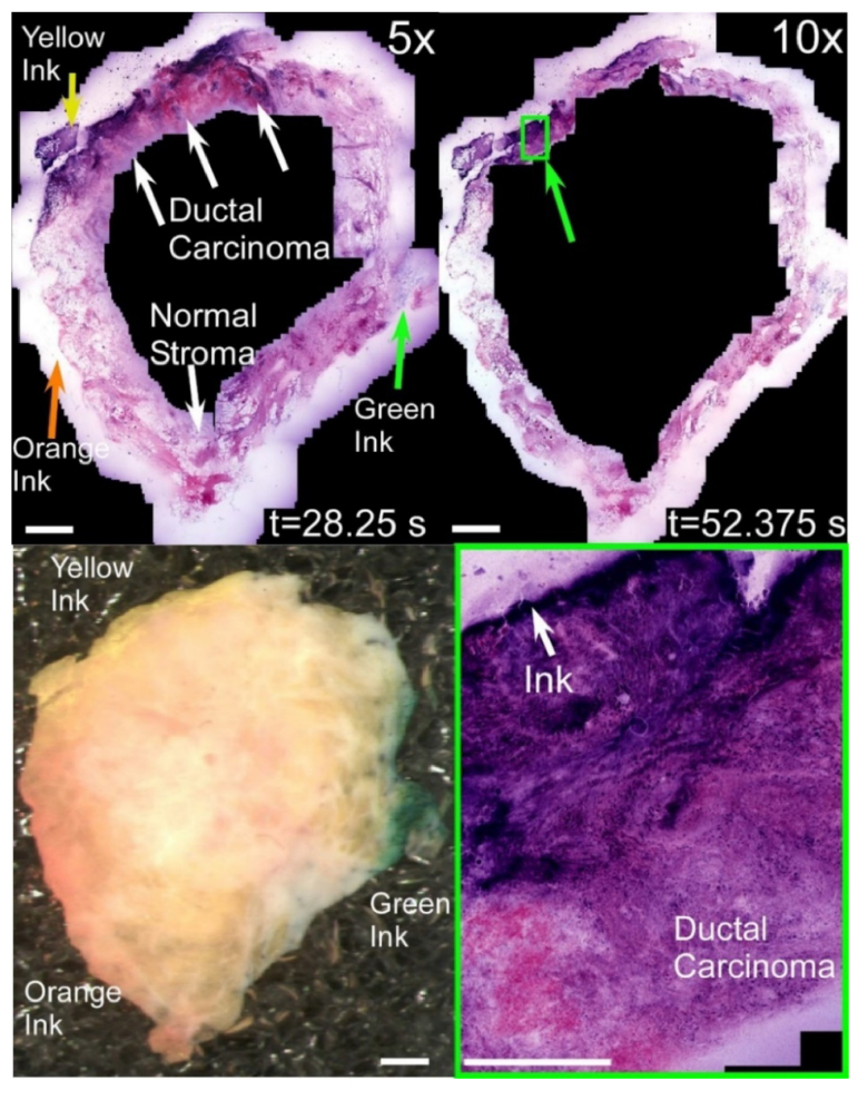 Fig. 12