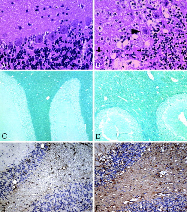 Fig 4.