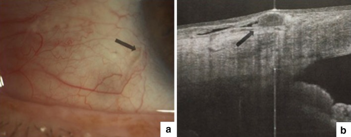 Fig. 1