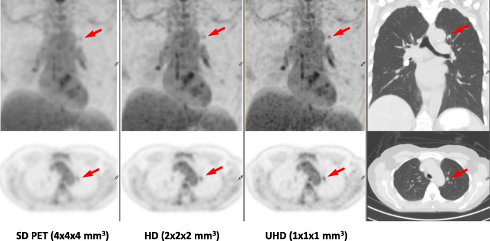 Fig. 10