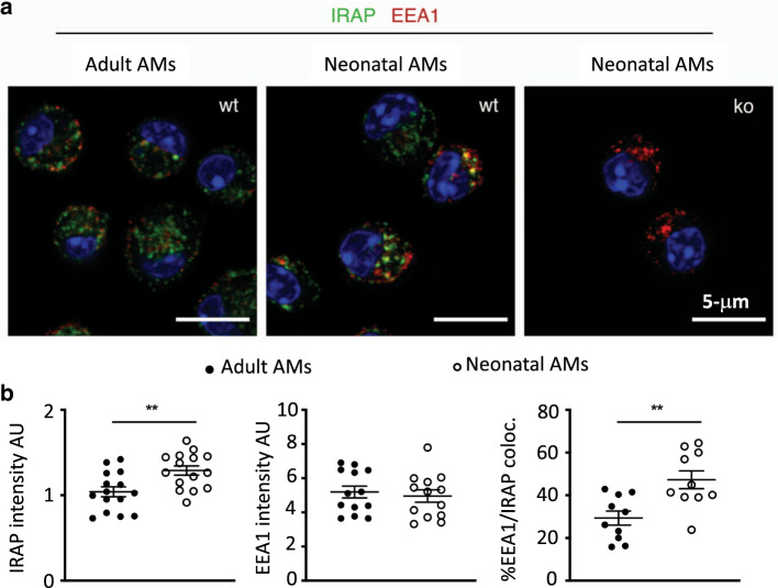 Control of IFN-I responses by the aminopeptidase IRAP in neonatal C57BL ... image.