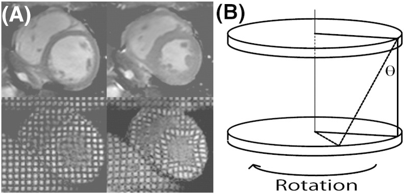 Fig. 1