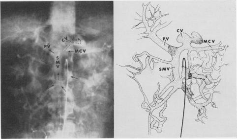 Fig. 15.