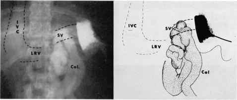 Fig. 5a.