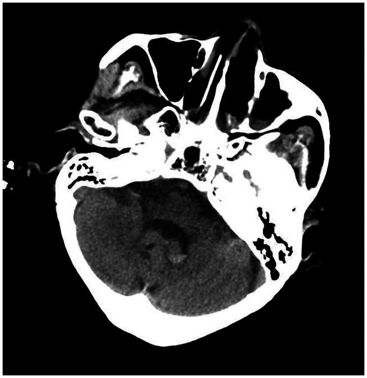 Figure 14.