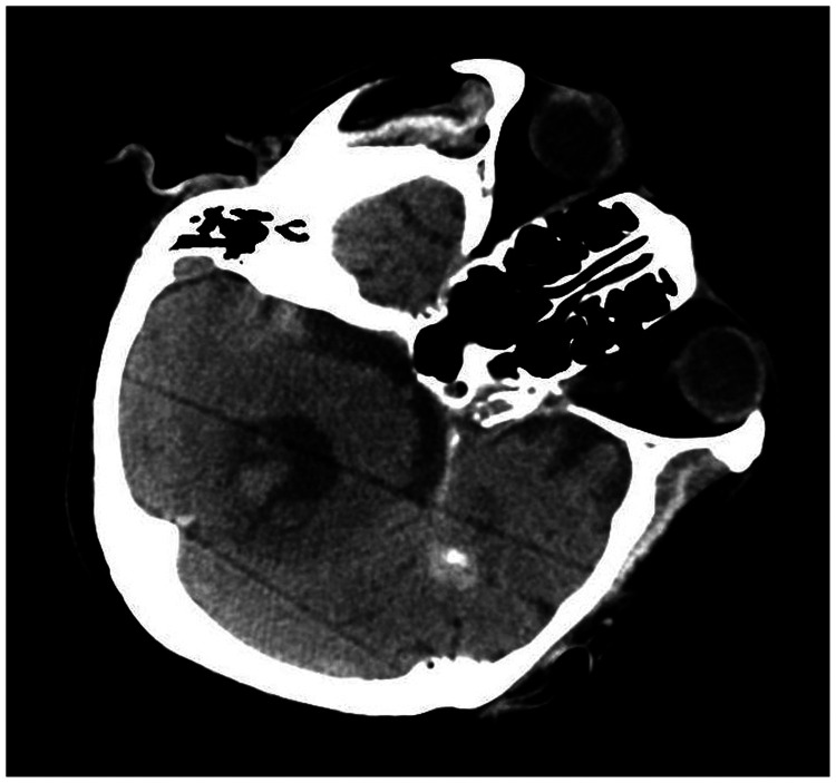 Figure 12.