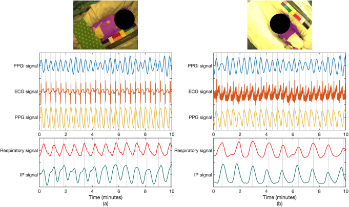 Figure 10.