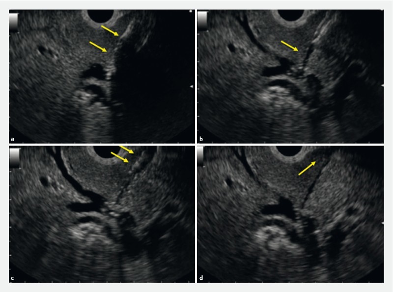 Fig. 3 a