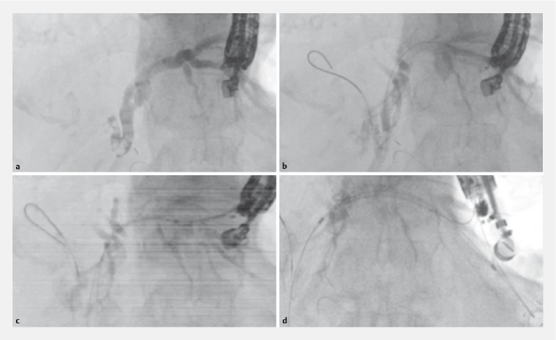 Fig. 2 a