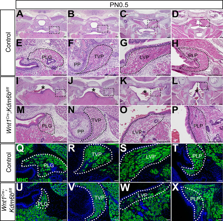 Figure 1—figure supplement 3.