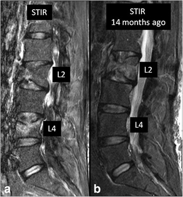 Fig. 10