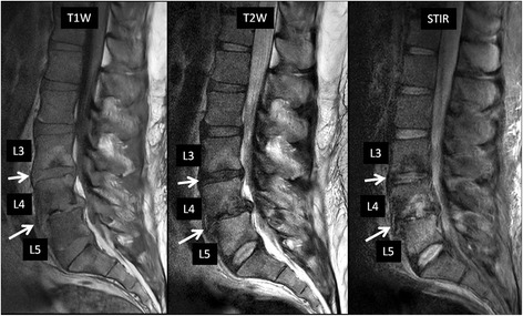 Fig. 13