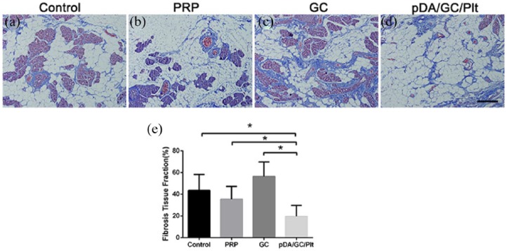 Figure 11.