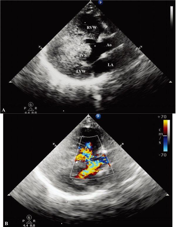 Fig. 2.