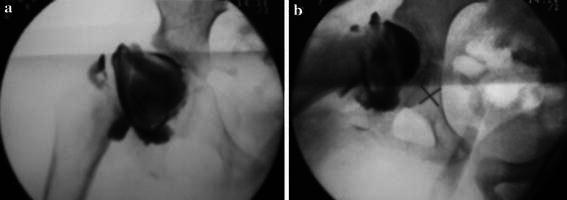 Fig. 1