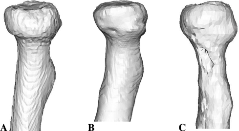 Fig. 4A–C