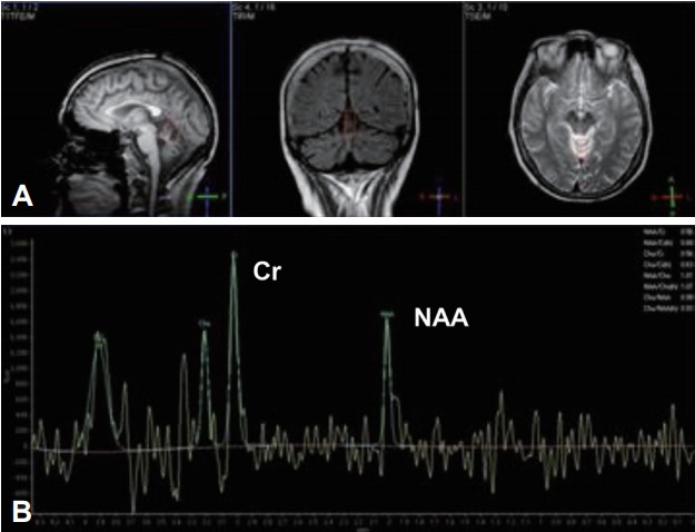 Figure 3.