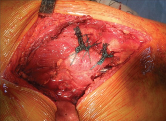 Fig. 1f