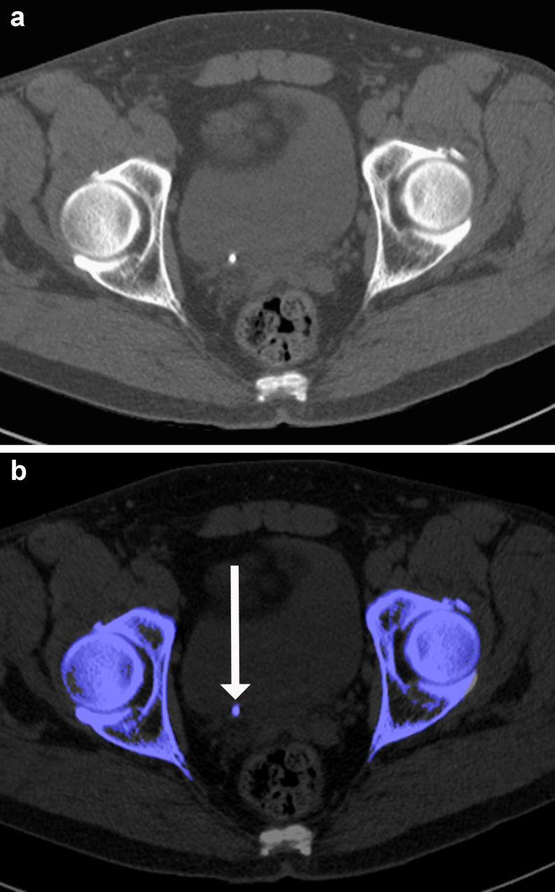 Fig. 5