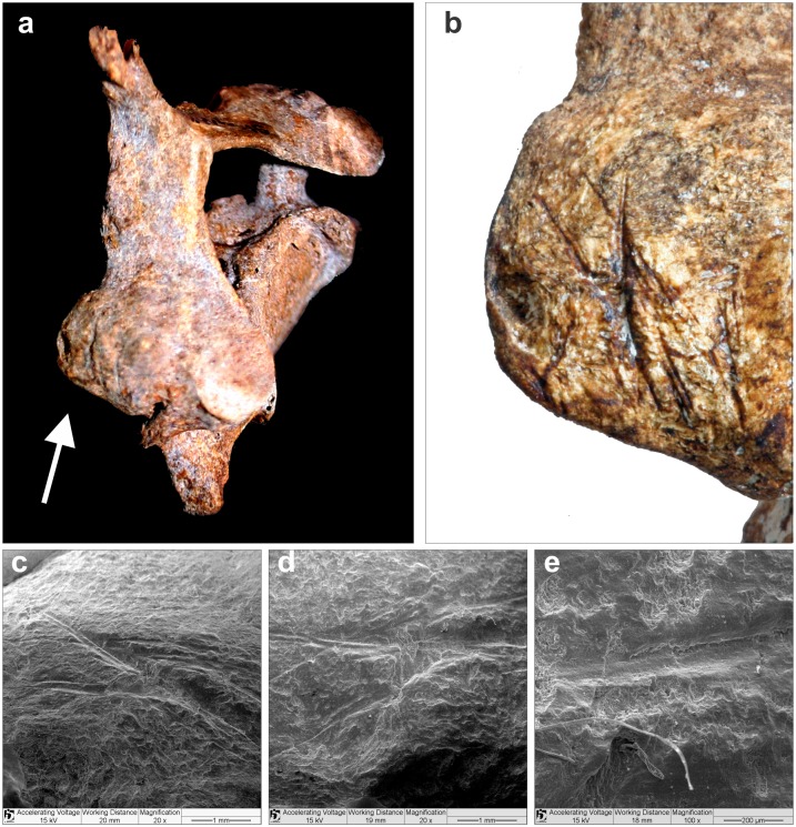 Fig 11