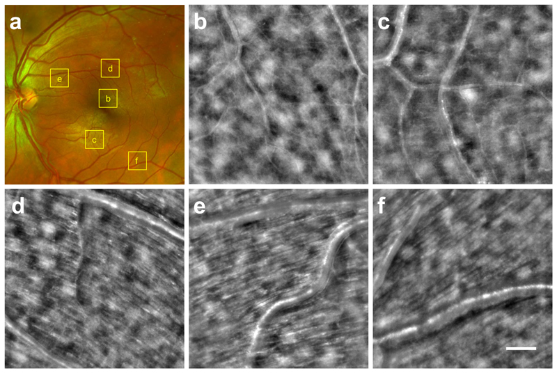 Fig. 4