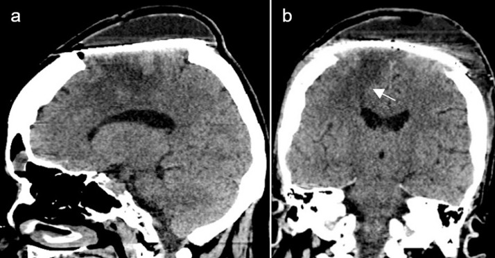 Fig 4