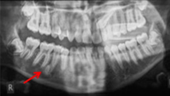 Fig. 12