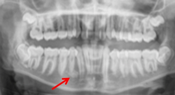 Fig. 14
