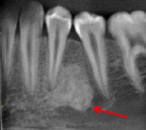 Fig. 5