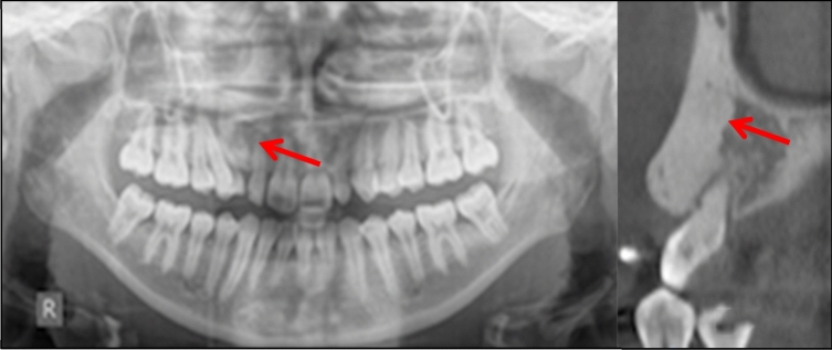Fig. 16