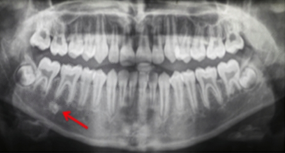 Fig. 11