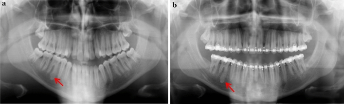 Fig. 10