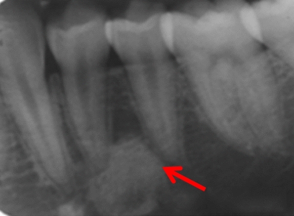 Fig. 4