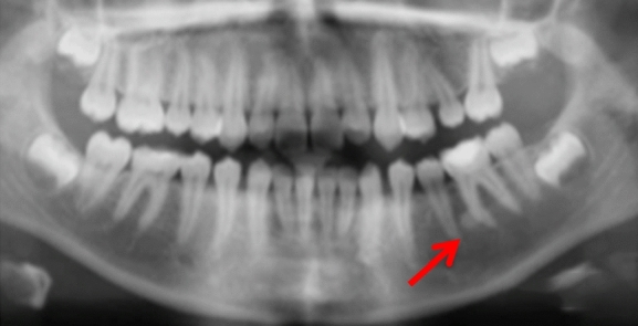 Fig. 9