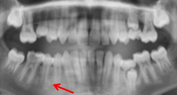 Fig. 13