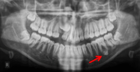 Fig. 7
