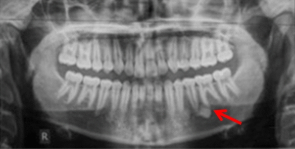 Fig. 8