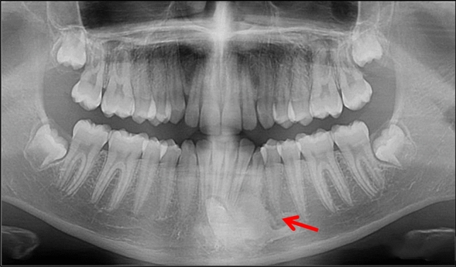 Fig. 15