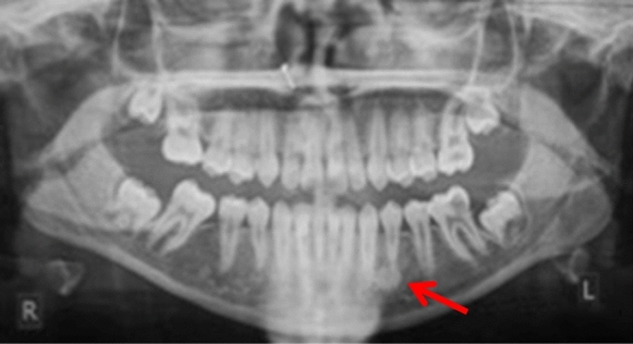 Fig. 6