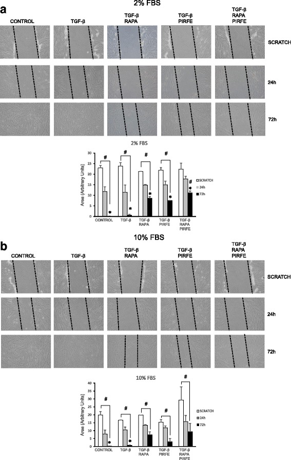 Anti-fibrotic effects of pirfenidone and rapamycin in primary IPF ...