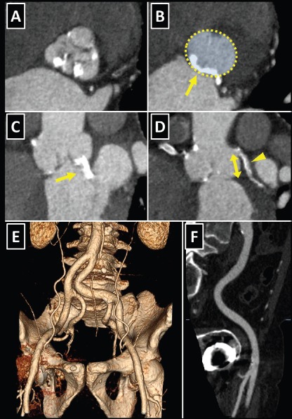 Figure 6: