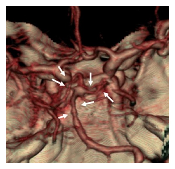 Figure 4