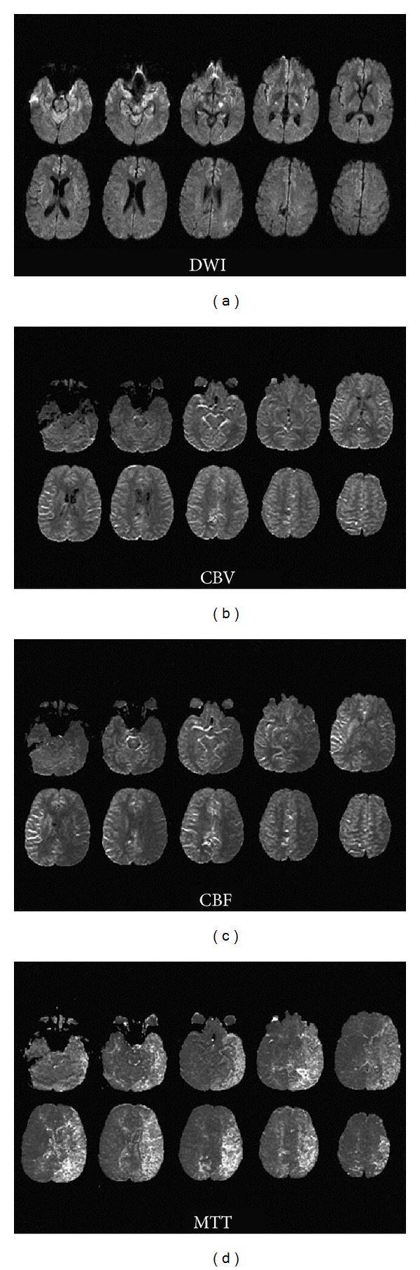 Figure 11