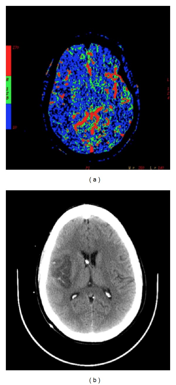 Figure 10