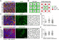 Fig. 4. Localization of Fzd6 in individual skin epithelial cells by genetic mosaic labeling. (A) Whole-mount immunostaining of E15.5 WT back skins with Fzd6 (green) and E-cadherin (Ecad, red) antibodies. (B) Diagrams showing the strategy used to visualize the localization of Fzd6 in individual skin epithelial cells. Flat-mount view of nine cells are shown. The cell in the middle (circled) is used to determine the localization of the Fzd6 protein. (C) Mosaic expression of Fzd6 was induced in Fzd6CKO/−; CAGG-CreERTM embryos treated with 4-HT at E10.5. E15.5 back skins were collected and stained with Fzd6 and E-cadherin antibodies. The right panel shows the schematic of the Fzd6+ versus Fzd6– cells. (D) Quantification of fluorescence intensity on anterior, posterior and mediolateral sides of the cells at the borders of Fzd6+ and Fzd6– clones. (E) Mosaic expression of 3×HA-tagged Fzd6 on a WT background was induced in Rosa26-LSL-Fzd6;CAGG-CreERTM embryos treated with 4-HT at E10.5. E15.5 back skins were collected and stained with 3×HA (green) and E-cadherin antibodies. The right panel shows the schematic of the 3×HA-Fzd6+ versus WT cells. (F) Quantification of fluorescence intensity on anterior, posterior and mediolateral sides of the cells at the borders of 3×HA-Fzd6+ and WT clones. Scale bars: 10 µm.