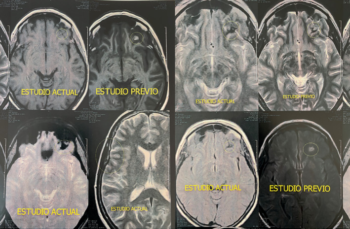 FIGURE 6