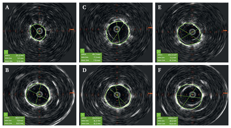 Figure 2